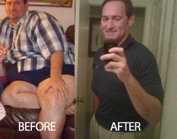 BEFORE-AFTER-DOUG